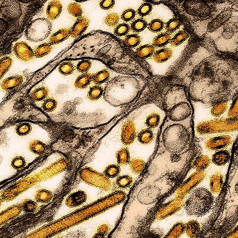 Puumala virus electron micrograph