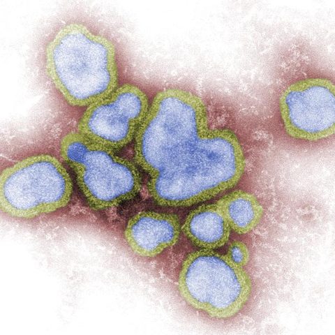 Poliovirus 2 electron micrograph