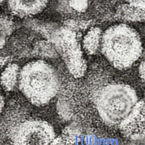 Bird Flu H9N2 electron micrograph
