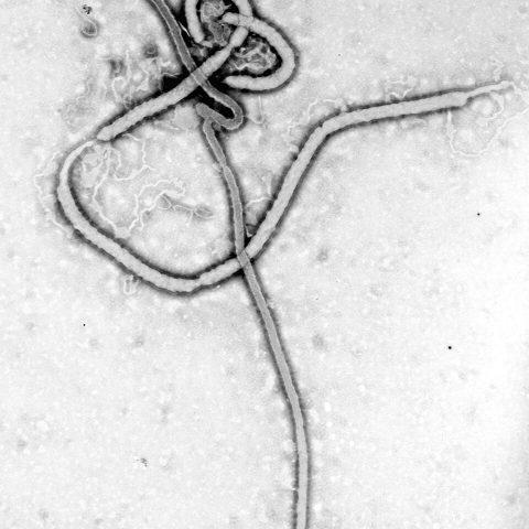 Hong Kong Flu 1968 (H3N2) electron micrograph
