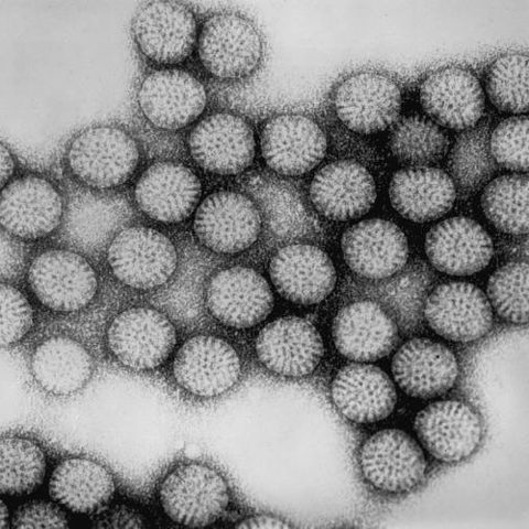Enterovirus D70 electron micrograph