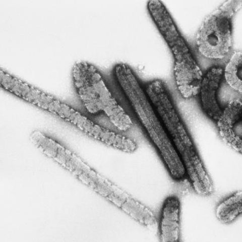 Swine Flu H3N2v electron micrograph