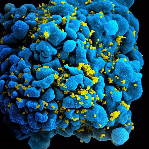 Bluetongue virus electron micrograph