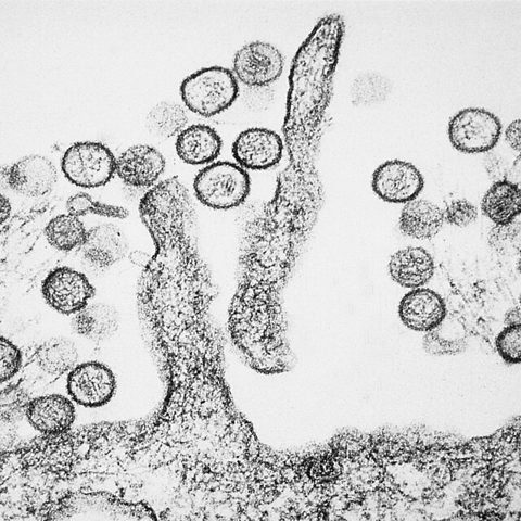 Hepatitis C virus electron micrograph