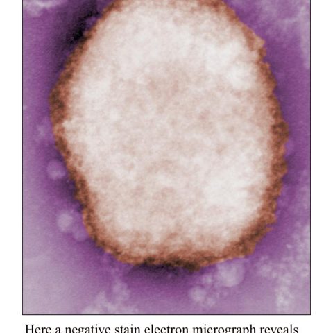 Hepatitis A virus electron micrograph