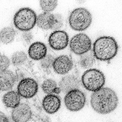 Canine parvovirus electron micrograph