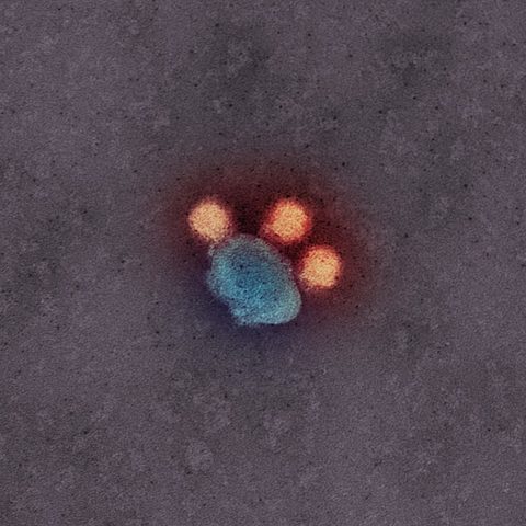 Bird Flu H7N9 electron micrograph