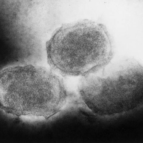 Coxsackievirus A24 electron micrograph