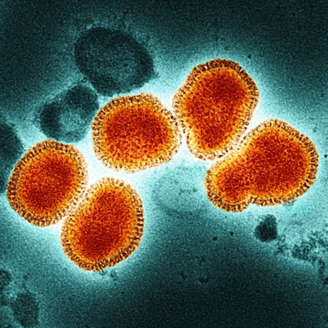 Hendra virus electron micrograph