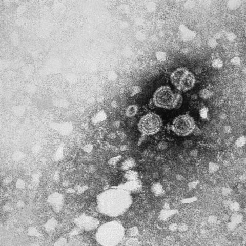 Dengue virus 2 electron micrograph