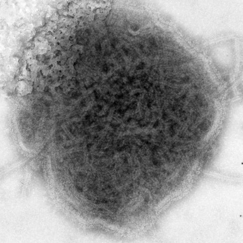 Mumps virus electron micrograph