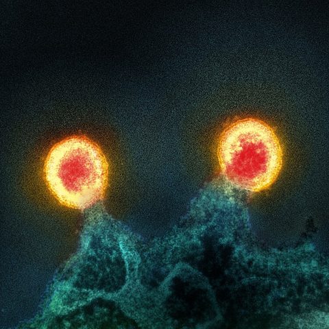 Lujo virus electron micrograph