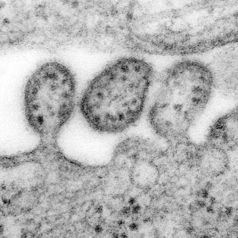 Respiratory syncytial virus B electron micrograph