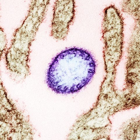 Influenza B Yamagata electron micrograph