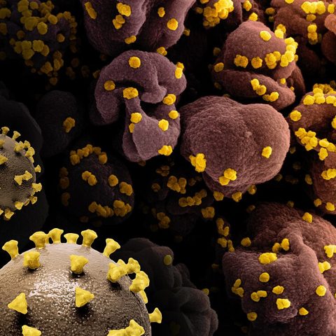 Russian Flu 1889 (Coronavirus OC43) electron micrograph