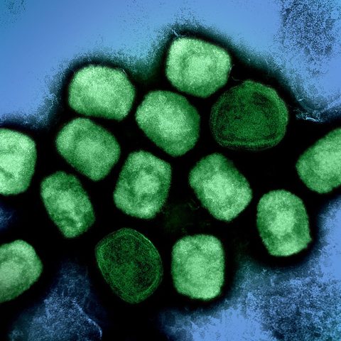 Bird Flu H10N8 electron micrograph