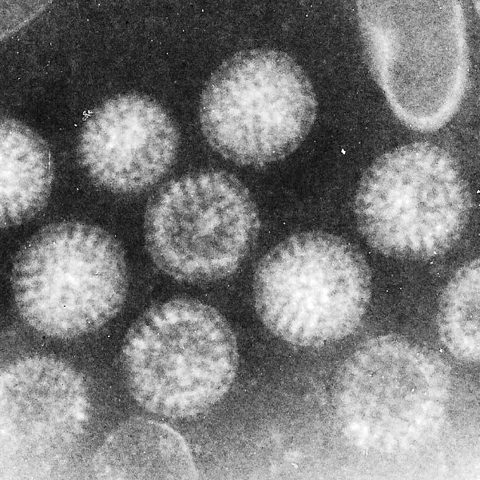 Swine Flu 2009 (H1N1pdm09) electron micrograph